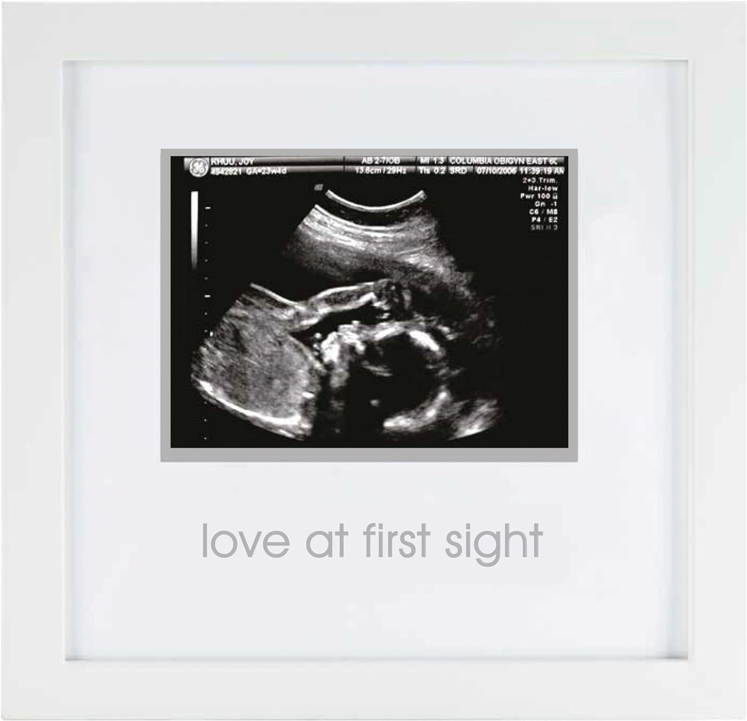 Small Sonogram Frame White